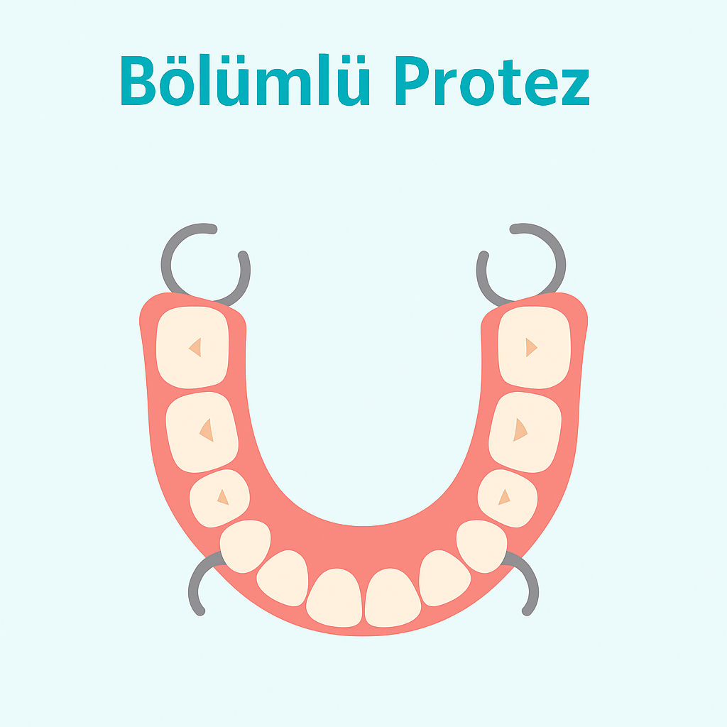 bolumlu protez ulusoyden
