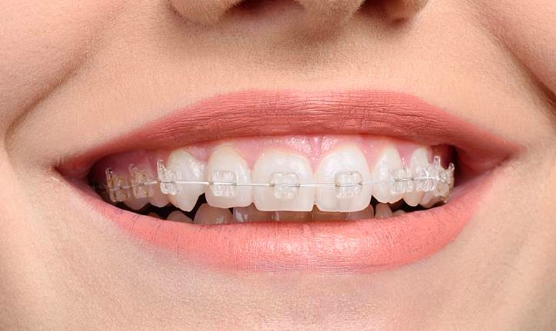 Sağlıklı Dişler Güzel Gülüşler