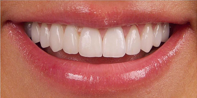 Pembeestetikzirkonyums