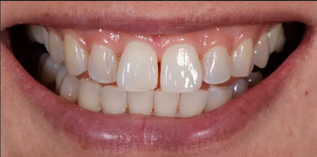 gtasarımı2 gtasarımı2