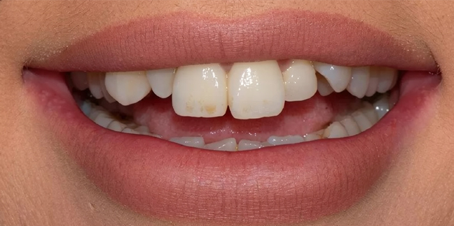 ordotontikzirkonyum ordotontikzirkonyum